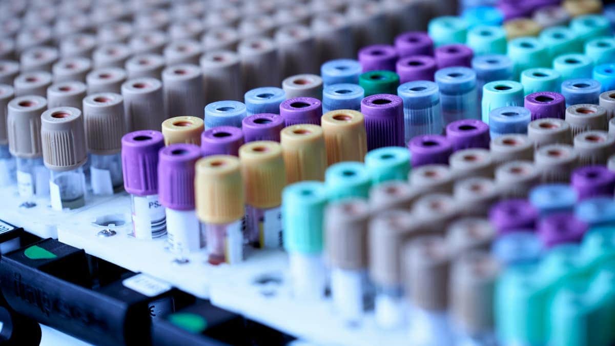 Tubes d'analyses sanguines au laboratoire pour un bilan de santé