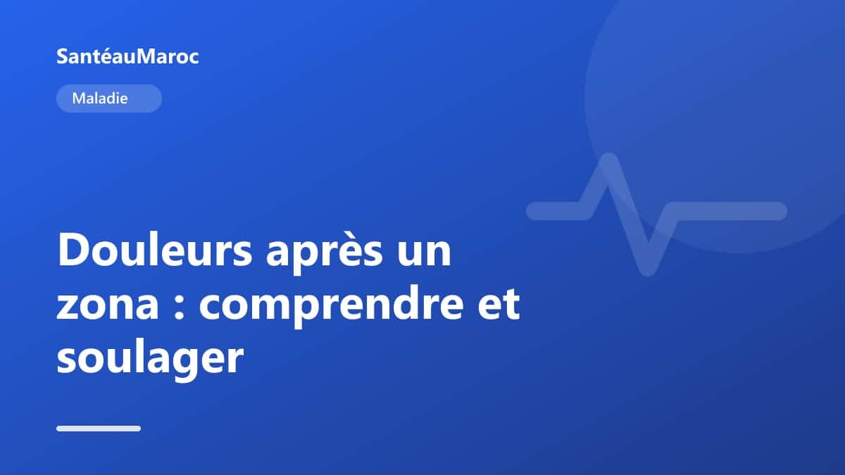 Maladie — Douleurs après un zona : comprendre et soulager