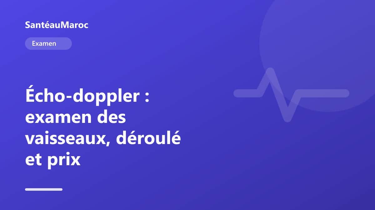 Examen — Écho-doppler : examen des vaisseaux, déroulé et prix