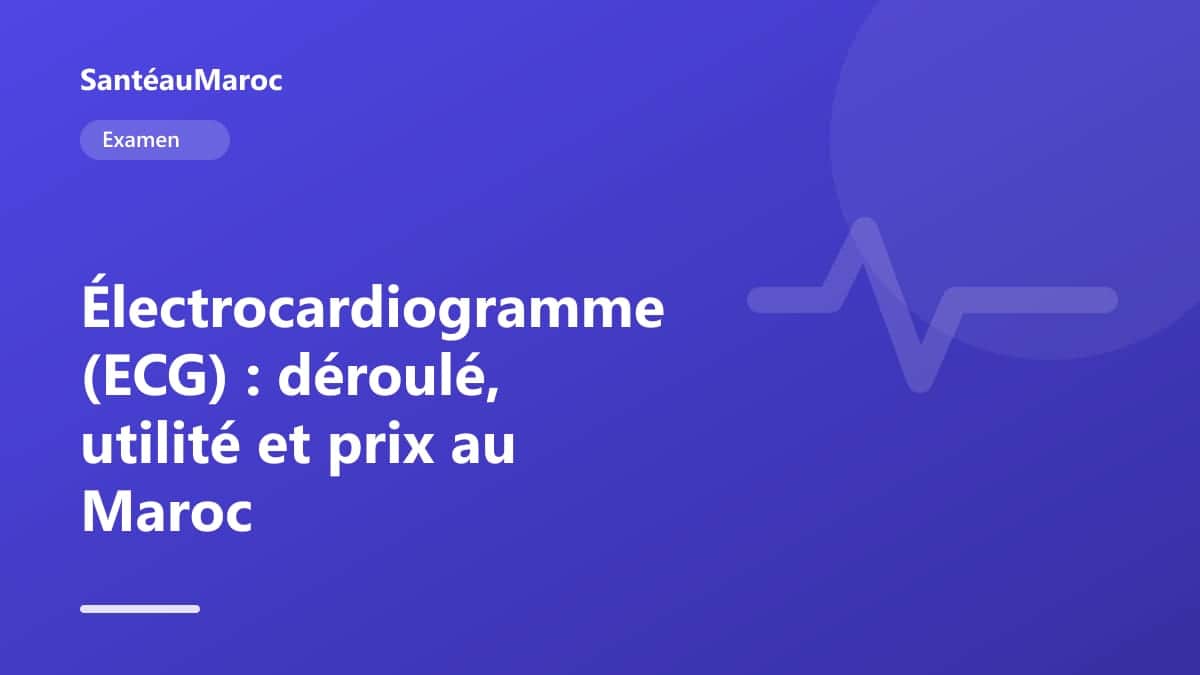 Examen — Électrocardiogramme (ECG) : déroulé, utilité et prix au Maroc