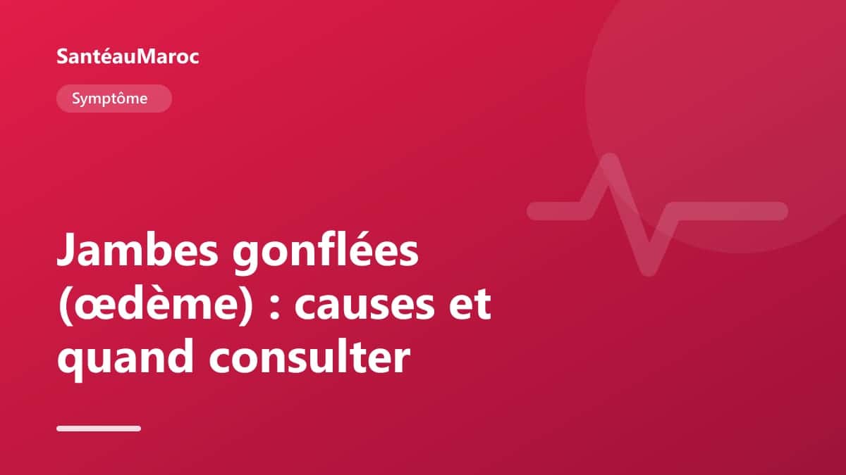 Symptôme — Jambes gonflées (œdème) : causes et quand consulter
