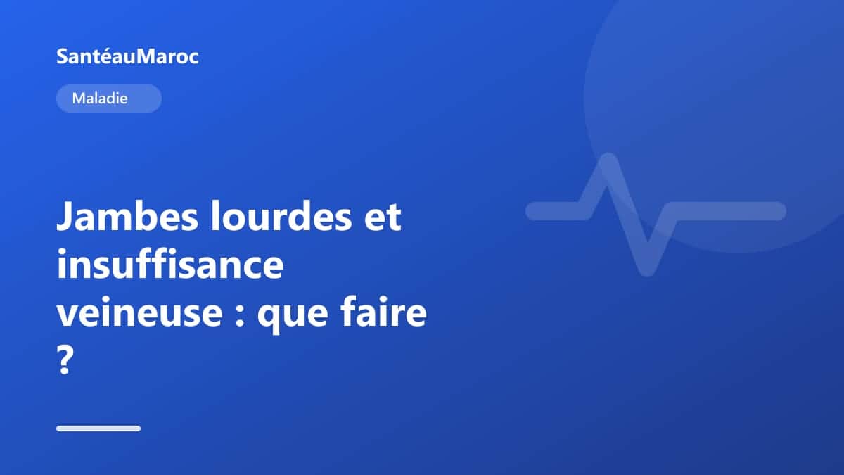 Maladie — Jambes lourdes et insuffisance veineuse : que faire ?