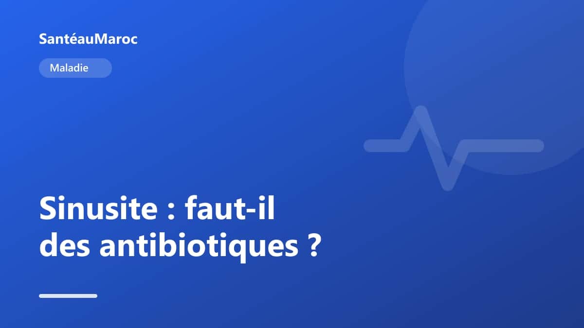 Maladie — Sinusite : faut-il des antibiotiques ?