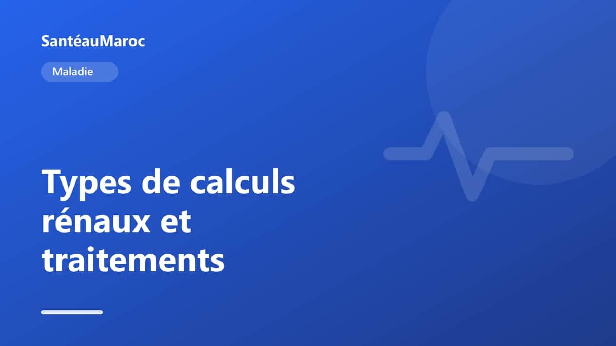 Maladie — Types de calculs rénaux et traitements