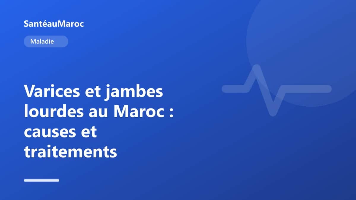 Maladie — Varices et jambes lourdes au Maroc : causes et traitements